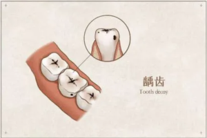 口腔健康 全身健康