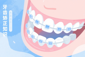 牙齿矫正之关于片切