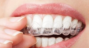 隐形矫治（隐适美 / 时代天使 / 正雅）