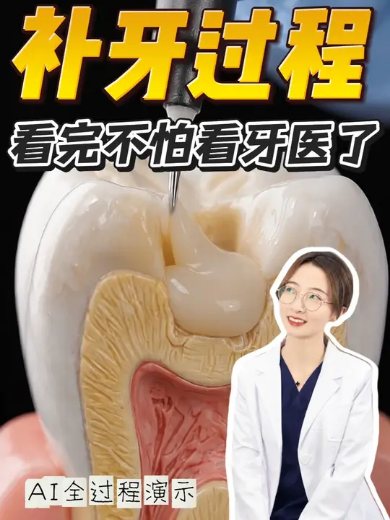 蛀牙到底是怎么被补好的？看完不怕看牙医！ 牙齿缺损是不可逆的。拖得越久，烂得越深，治疗越复杂，费用也成倍增长。在只是“小黑点”阶段补牙，是解决牙齿问题性价比最高的时候哦！#补牙